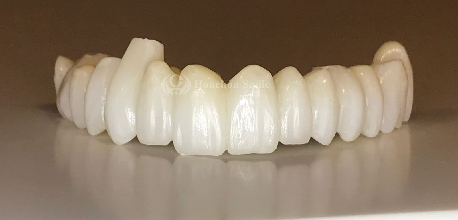 UT Case ( Ultra Translucent Zirconia)