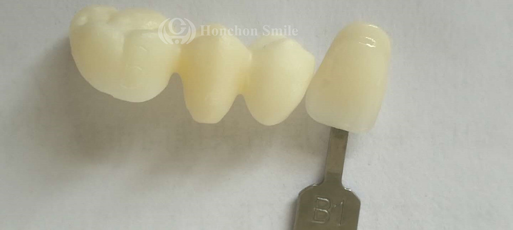 HT-C Case ( High Translucent colored Zirconia )