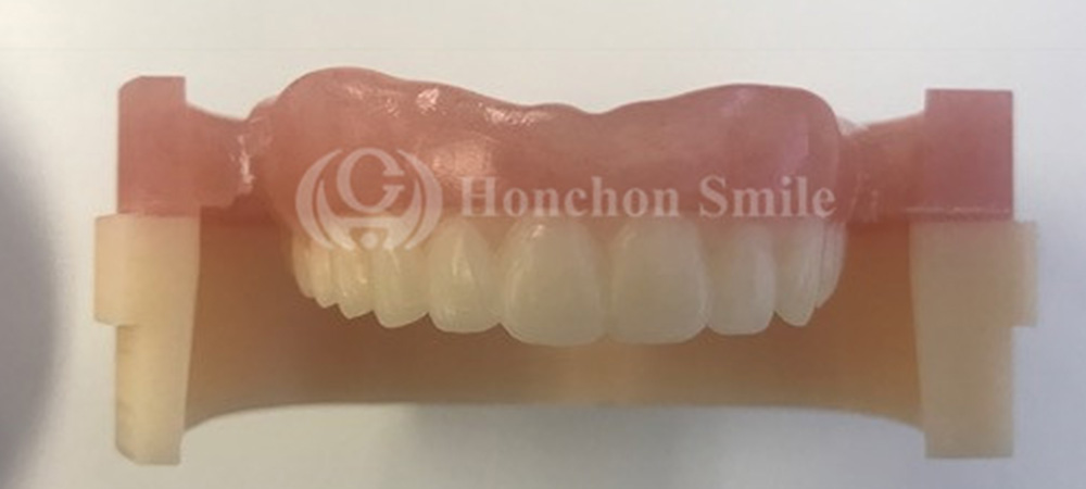 Denture Pink and A2 Color