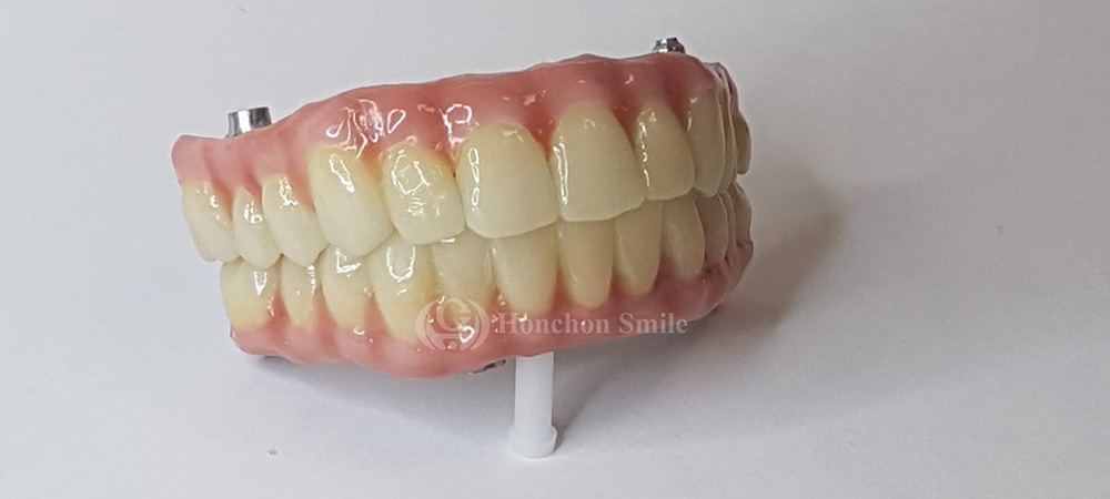 UT-C Case( Ultra Translucent Colored Zirconia)