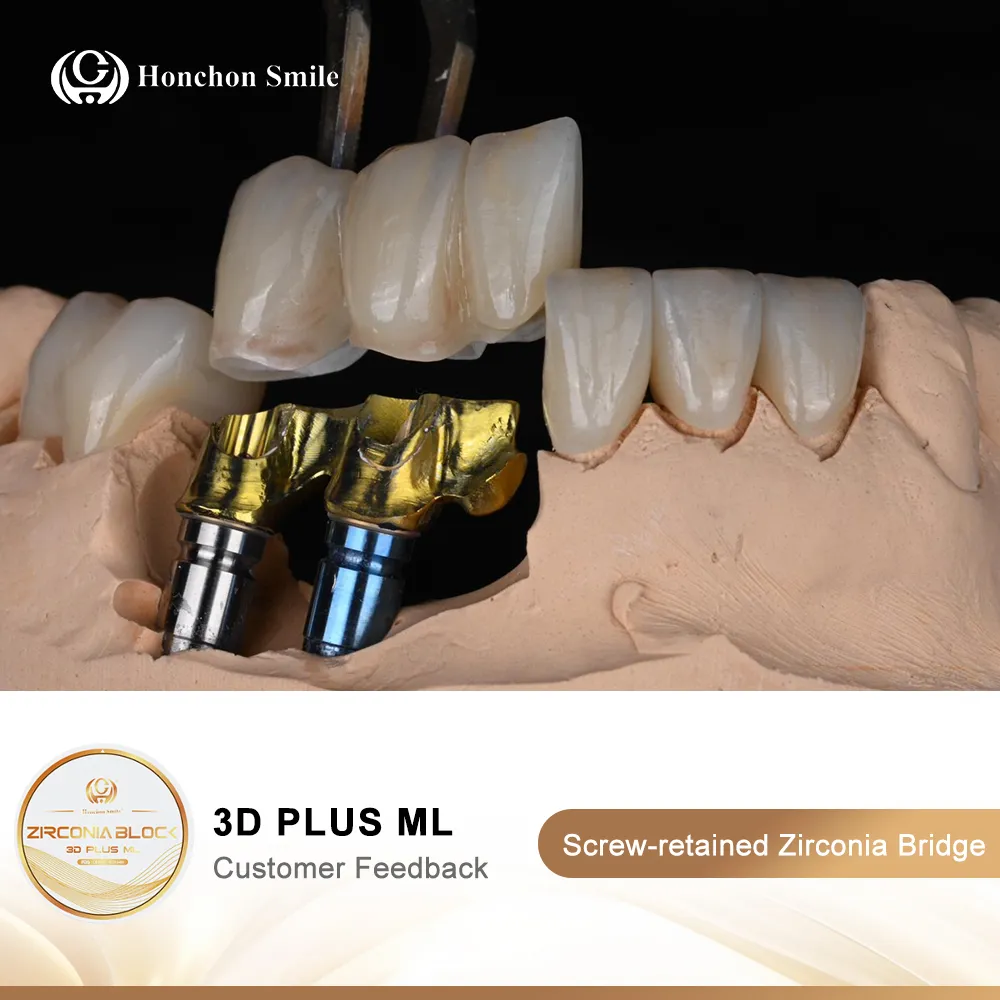 Zirconia Dental Bridges in 2025: Benefits, Costs, and Professional Insights