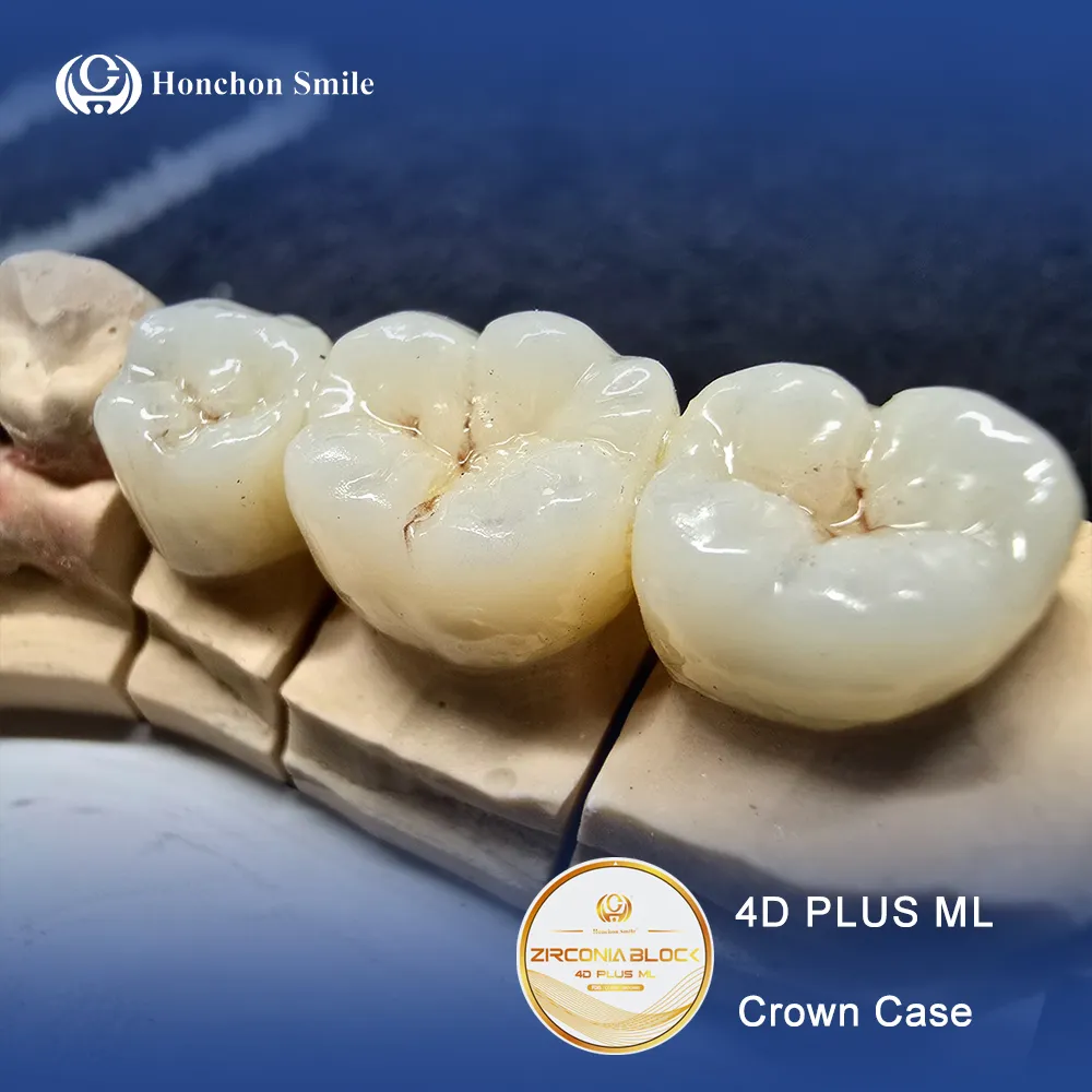 Dental Crowns